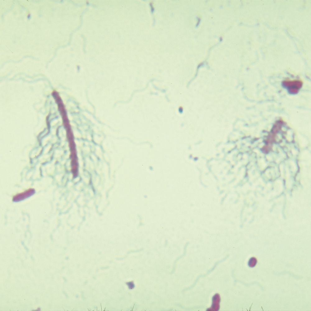 Bacterial Flagella Slide, Peritrichous, W.M.