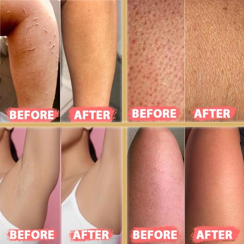 Kelebek für Gesicht & Körper 2er-Set Peeling-Handschuhe – Türkisches Kese für Damen & Herren – Exfoliating Gloves für Dusche & Hamam – Körperpeeling & Tiefenreinigung