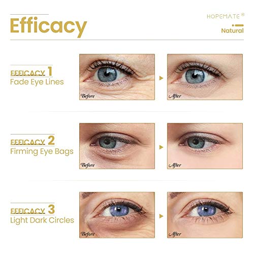 Kit Beleza Facial Sérum Vitamina C20% + Retinol 2,5% E Creme para olhos