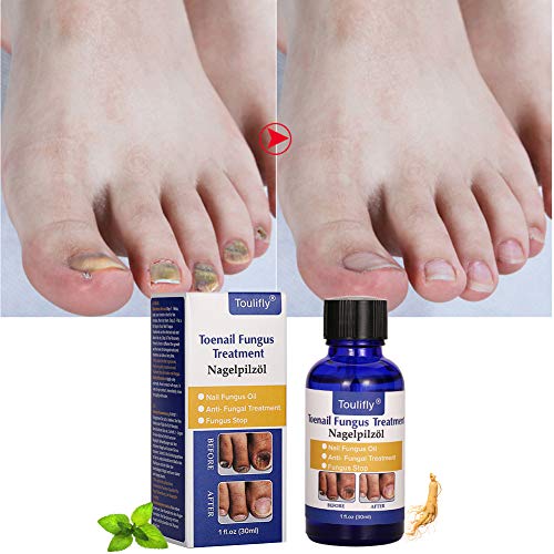 Nagelpflege und Behandlung, Nagelpflege für gesunde Fuà und Hand, Nagelpflegeöl,Nagelpflege pflegend – Bild 3