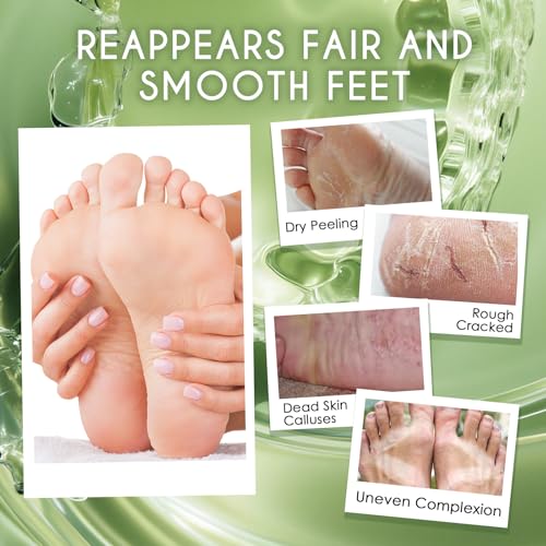 Foot Peel Mask 2 Pairs(Avocado + Aloe vera),Exfoliating foot skin mask is suitable for hard skin,peeling socks, A gift for women and men,Gentle and Moisturizing formula, Remove dead skin and repair he - Image 4