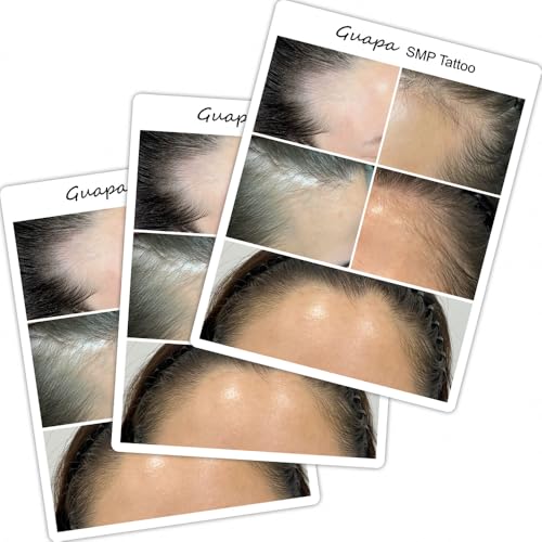 3PCS/Pack Scalp Micropigmentation Practice Skin – Printed SMP Tattoo Training Pad for Hairline Design & Dot Work – Ideal for Beginners & Artists (3PCS Design #2)