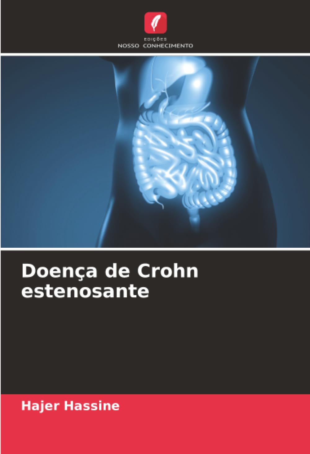 Doença de Crohn estenosante