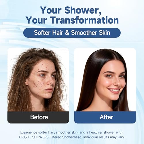 Image of BRIGHT SHOWERS Filtered Shower Head with Handheld, High Pressure 9 Spray Mode Showerhead with Long Hose and Bracket, Water Softener Filters Beads for Hard Water - Removes Chlorine, Oil-Rubbed Bronze