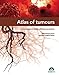 Atlas of tumours. Oncology in daily clinical practice