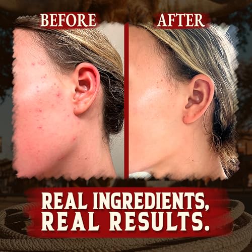 image for Wrath & Remedy Organic Beef Tallow for Skin - 4 OZ (Unscented) — Gra