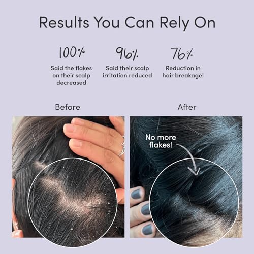 Jupiter-Anti-Dandruff-Shampoo-Conditioner-Serum-Advance-Set-Physician-Formulated-For-Dry-Itchy-Oily-Flaky-Scalp-Care-Color-Safe-Dry-Scalp-Sulfate-Free
