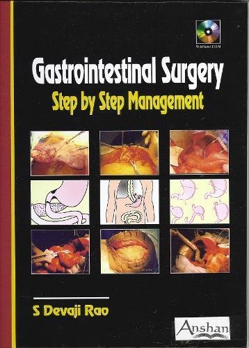 Gastrointestinal Surgery: Step by Step Management