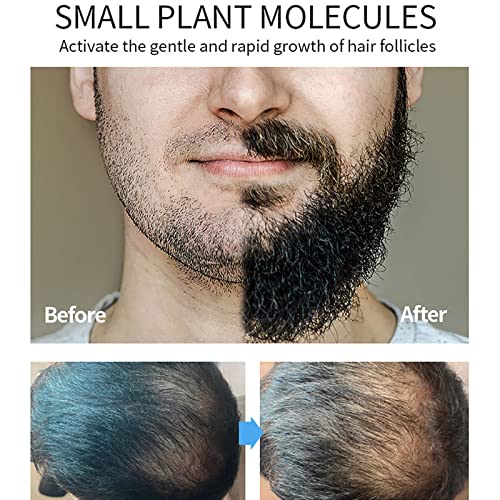 Óleo de Barba para Crescimento Masculino, 50ml Óleo de Barba para Crescimento da Barba, Essência de