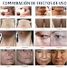 Imagen de Máquina Hifu Reafirmante Profesional 7d Para El Cuidado Y Rejuvenecimiento Facial Y Corporal