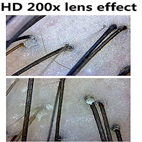Haarfollikel-Analysegerät, 9-Zoll-LCD-Bildschirm, einfache Bedienung, wiederaufladbar, multifunktionales Kopfhaut- und Hautanalysegerät