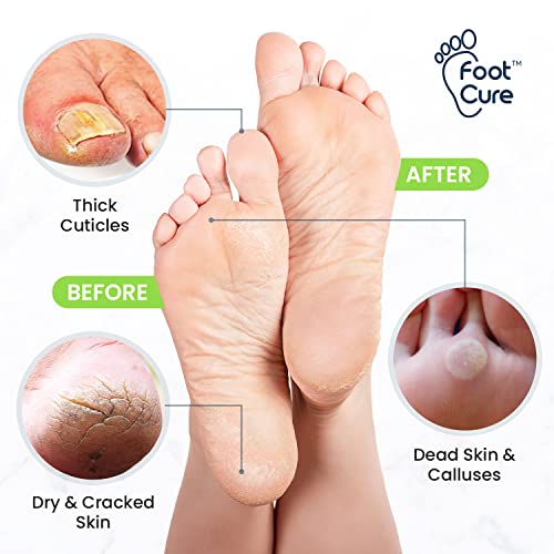 image for FOOT CURE Toenail Fungus Treatment Extra Strength - for fingernails, n