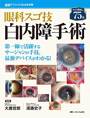 無料電子書籍 おすすめ 眼科スゴ技 白内障手術: WEB動画付き 75本 第一線で活躍するサージャンの手 バイ