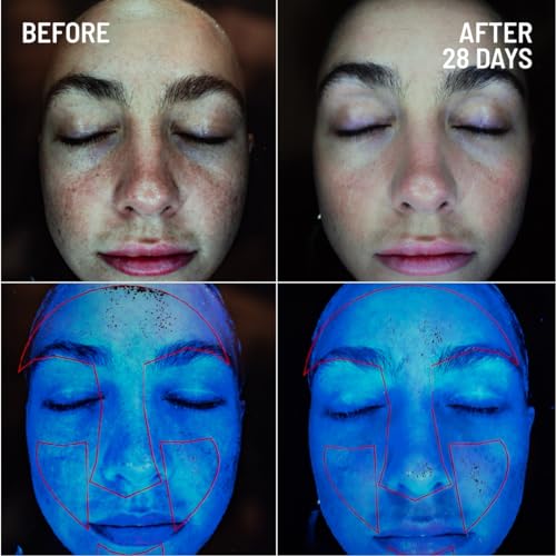 Dr-Brandt-Microdermabrasion-Renewing-Face-Exfoliator-Reduces-Dull-Skin-Uneven-Texture-Fine-Lines-Acne-Scars-and-Wrinkles-2-oz-60-g