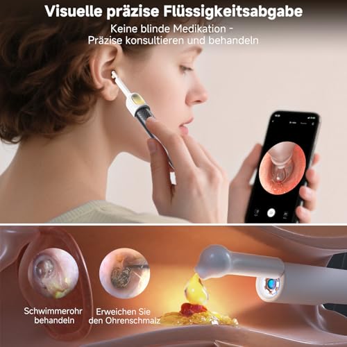 BEBIRD R1 Ultra Ohrenschmalz Entferner Kamera, Ohrenreiniger mit Otoskop für Zuhause, Komplett-Set mit Sichtbarer Dropper & Pinzette, Für Ohr & Nase & Rachen Untersuchung der Familie-Schwarze