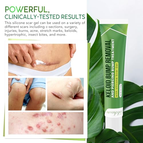 Tobcharm TOBCSCAR002 Advanced Keloid Bump Removal Gel: Silicone Keloid Scar Removal Cream thumb #5
