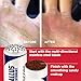 Callus Score – Precision Hand Callus Remover for Athletes | Prevents Ripping | Callus Management for Weightlifters, Cross Training, Gymnastics and More | Callus Performance - we just do calluses