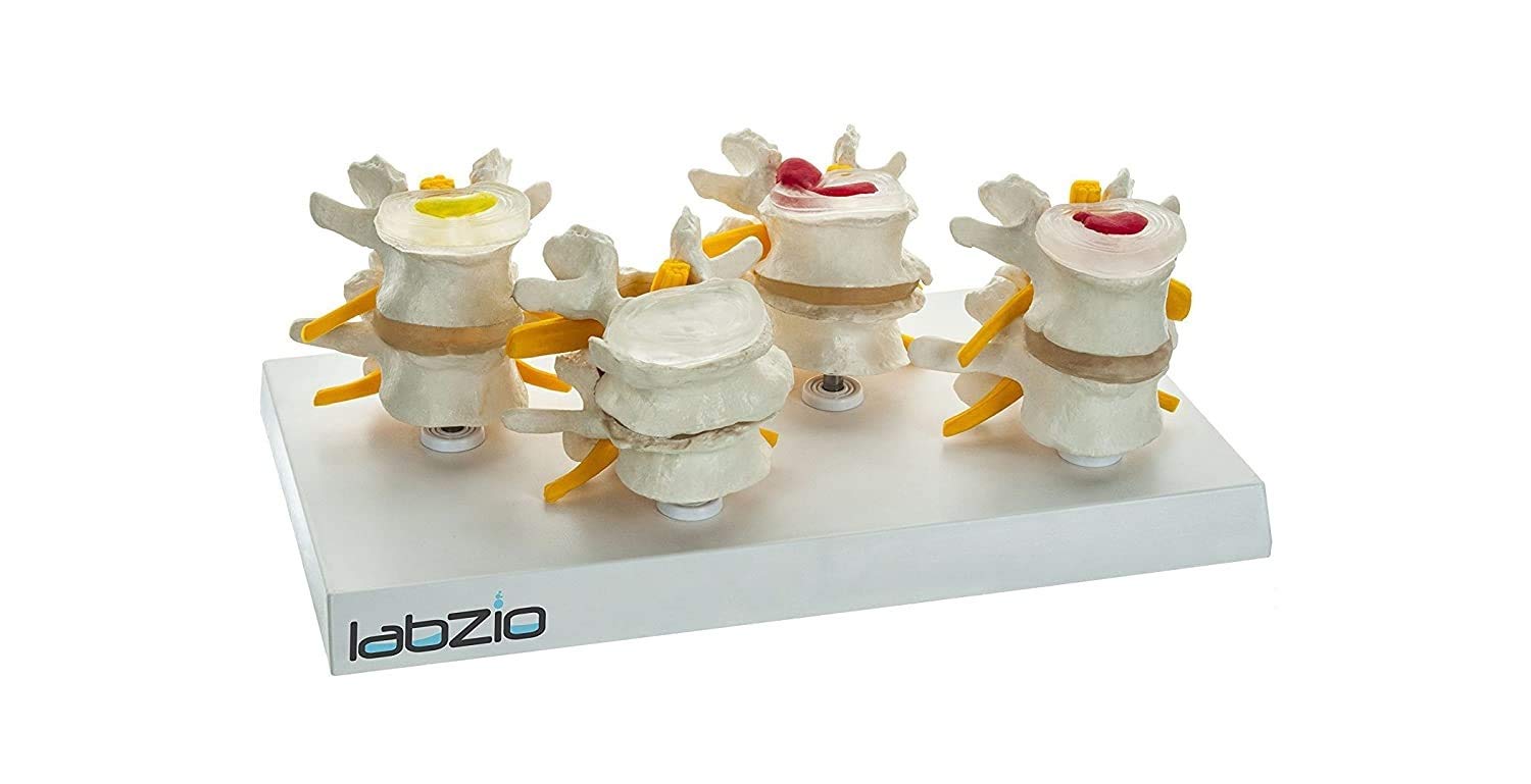 See full amazon price history chart for LABZIO, 4 Stage Vertebrae Diseases Model, 4 Parts, Removable, Premium Anatomical Model, Model On Base With Detailed Study Guide, White LABZIO, 4 Stage Vertebrae Diseases Model, 4 Parts, Removable, Premium Anatomical Model, Model On Base With Detailed Study Guide, White (B075NDVJJX) Amazon Price History, Amazon Price Tracker