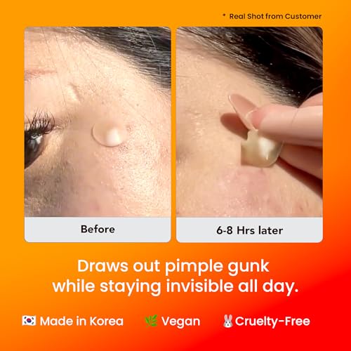 AVARELLE Acne Cover Patch Guardian Invisible UPF 50+ Daytime Sun Guard — view 3