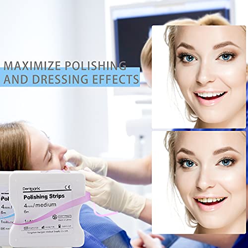 dental polishing strip - dental file for teeth sanding grinding deep teeth cleaning tool teeth abrasive finishing strip dental care 4mm x 6m 1roll