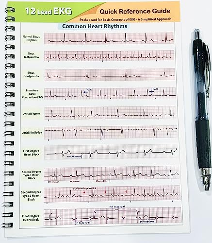 Healthing Aprn World Ekg Pocket Card thumb #1
