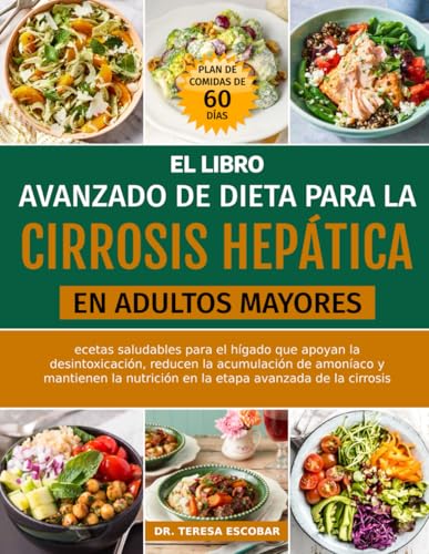 EL LIBRO AVANZADO DE DIETA PARA LA CIRROSIS HEPÁTICA EN ADULTOS M...
