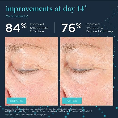 AmazonUs/F5NME NEOCUTIS Lumiere Firm - Illuminating and Tightening, Anti-Aging Eye Cream - Brighten, Hydrate, and Soothe - for Dark Circles, Puffiness, and Wrinkle Prevention - Travel-Friendly - 15 ml / 0.5 fl oz