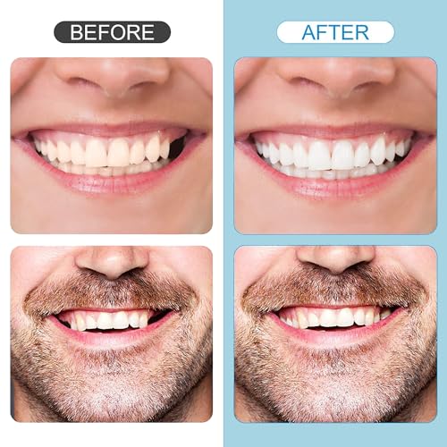 Image of Tooth Repair Kit，Temporary Natural Shade for Filling The Gap, Moldable Thermal Beads Replacement Kit Replace The Missing or Broken Tooth-6PCS-D34