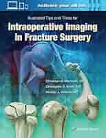 健康・医学 Harborview Illustrated Tips and Tricks i Harborview Illustrated Tips and Tricks in Fracture
