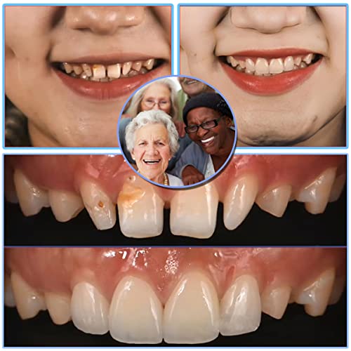 Tooth Repair Kit，Diy Dental Care Kit For Crowns Filling Temporary Teeth Replacement Veze 12347 #TOP3