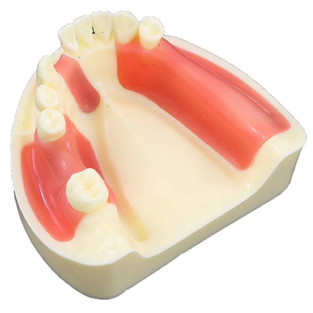 Modèle d'implant mandibulaire pour pratique du lambeau et perçage dentaire