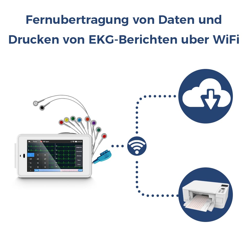 Wellue PG12 ECG professionale a 12 derivazioni, dispositivo ECG digitale con algoritmo di Glasgow, acquisizione e analisi dei dati ECG in tempo reale, trasferimento dati WIFI e stampa dei report
