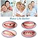Tooth Repair Kit for Fixing the Missing Chipped and Broken Tooth Gap Temporary Replacement Thermal Beads and Fake Teeth Brace Mold