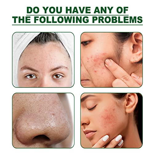 DOYING 1 peça em bastão de barro chá verde M-ask removedor de cravos limpeza profunda dos poros para