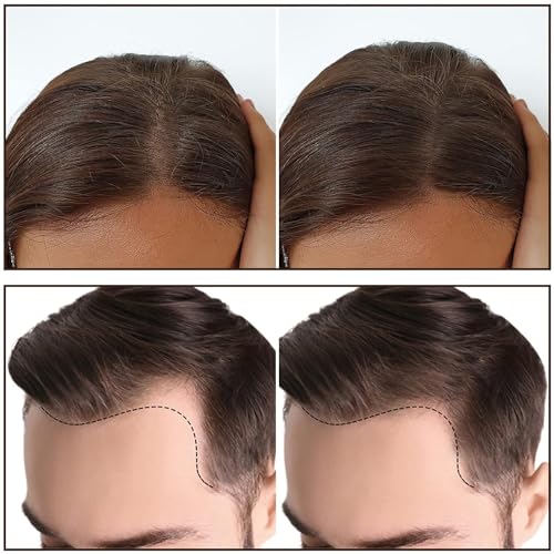 Image of Hairline Powder Stick, Hair Shadow Root Touch Up, Waterproof Shading Sponge Pen Filler for Cover Gray, Touch-Up, Thin Hair (Black)