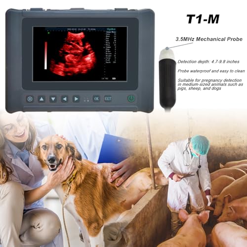 ultrasound machine 2026 29