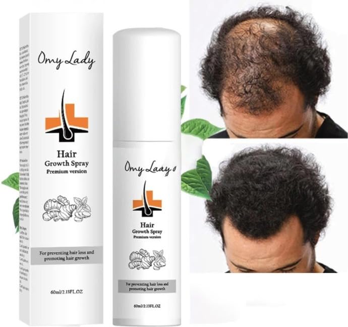Serum do włosów – stymulator wzrostu włosów – przeciw wypadaniu włosów – serum na porost włosów – spray na porost włosów – 60 ml