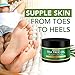 Tea Tree Oil Foot Cream For Dry Cracked Heels Repair - Natural Foot Cream For Dry Cracked Feet, Heel Balm & Foot Moisturizer For Healthy Feet