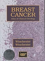 American Cancer Society Atlas of Clinical Oncology: Breast Cancer (Book with CD-ROM) 1550091123 Book Cover