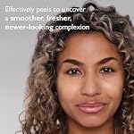 Peter Thomas Roth | FIRMx® Peeling Gel | Gentle Facial Exfoliant for Dullness, Pores and Uneven Texture - Image 4