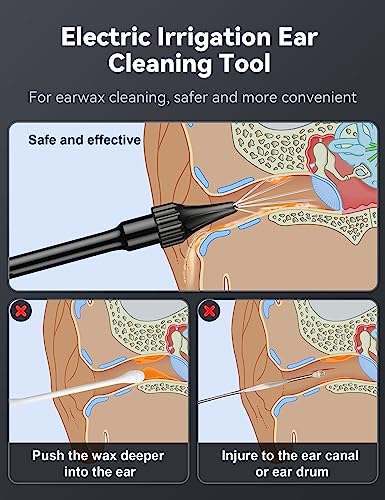 Kit per Rimozione Cerume, Pulisci Orecchie