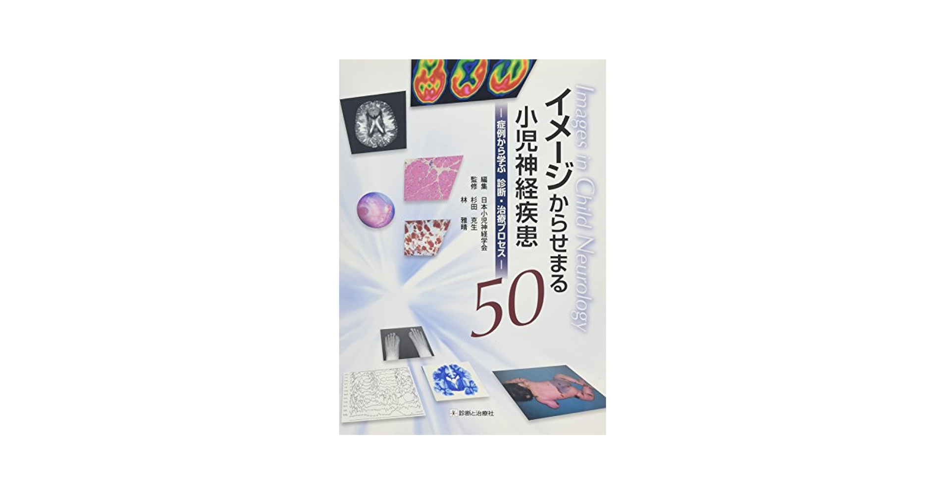 小児神経学の進歩  第２７集 /診断と治療社/日本小児神経学会（単行本） 小児神経学の進歩 第27集 /診断と治療社/日本小児神経学会（