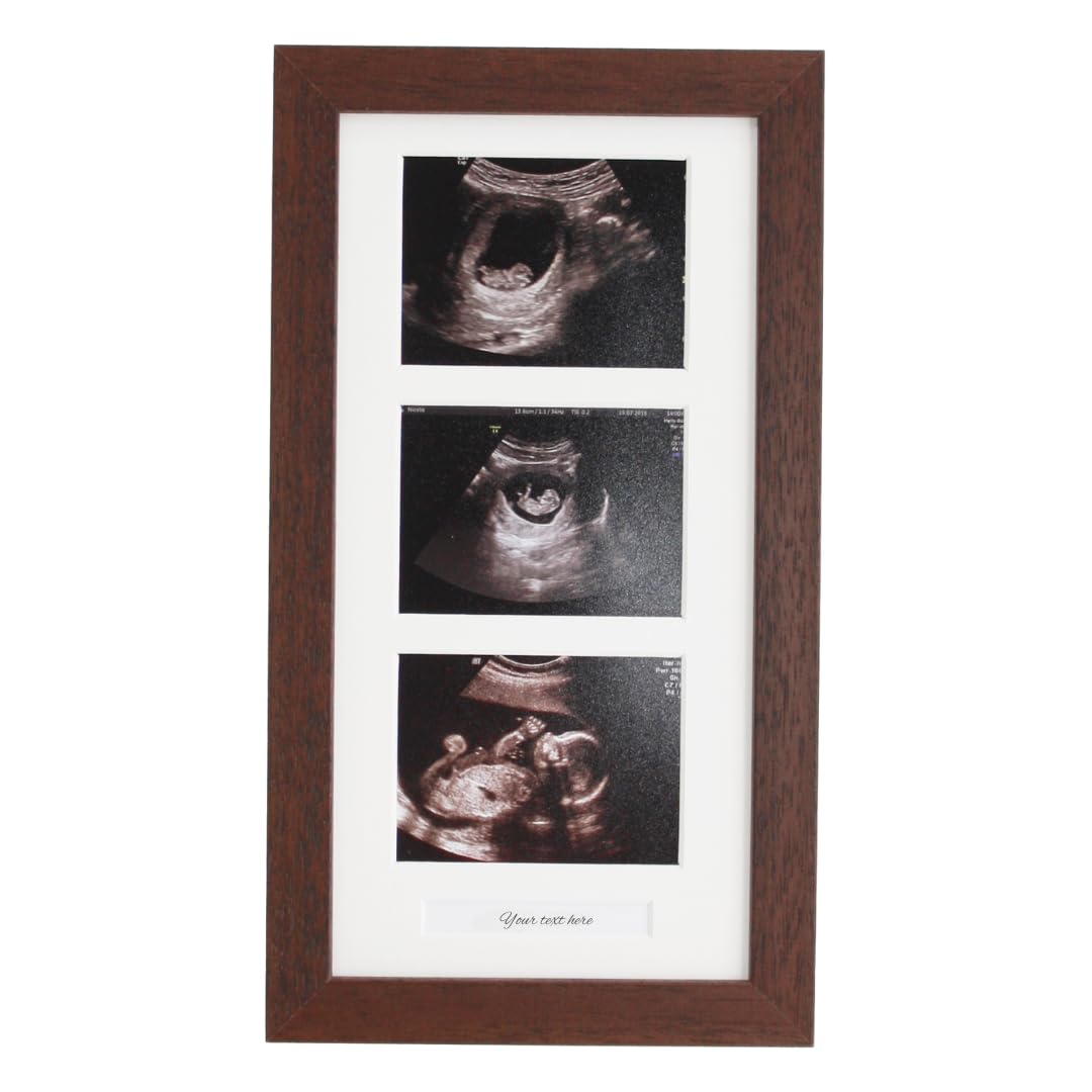 Baby Scan Photo Frame. Optional Personalisation. Multi Aperture Frame to display Three Ultra sound photographs. Pregnancy announcment | Baby Shower | Pregnancy Keepsake (Walnut Frame)
