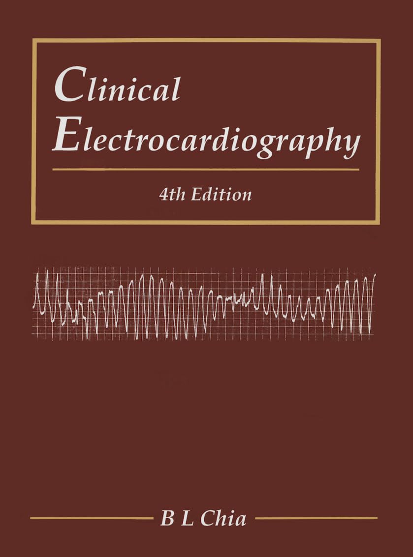 Clinical Electrocardiography (Fourth Edition): 4th Edition