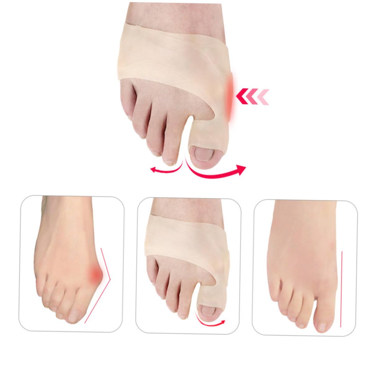 Gogogmee 2 Set Splitter Mallet Trigger Splint Bunion Pads Bunion Aid Big Splint Bunion Brace Big Separator Bunion Straightener Separator Bunions