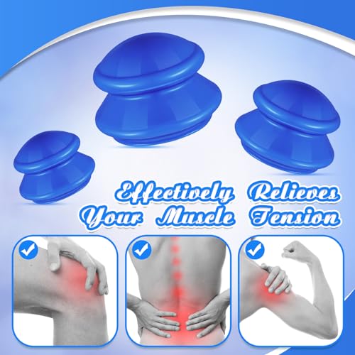 Image of TrelaCo 6 Pcs Silicone Cupping Kit for Massage Therapy,Solid Blue | Cupping Cups 3 Sizes, Suction Therapy for Body Massage Myofascial, Relieves Cellulite Muscle Pain Tension, Studio Household