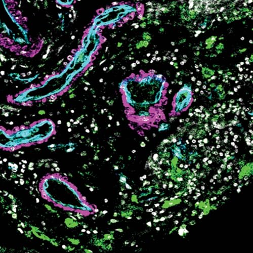 Tangled Blood Vessels With Dr Ethan Winkler Podcast Por  arte de portada