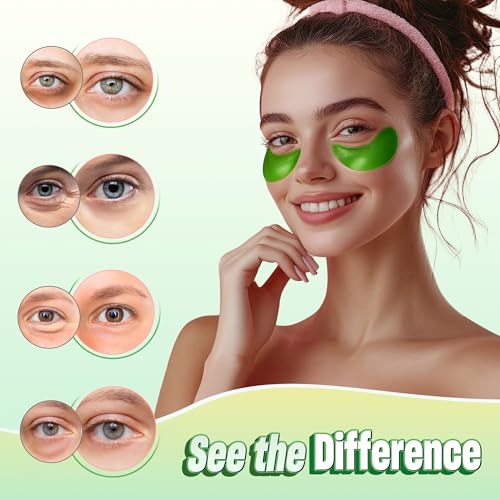 Image of NAZANO Under Eye Patches - 60 Pack Eye Masks | for Puffy Eyes, Dark Circles, Bags & Wrinkles with Collagen & Hyaluronic Acid - Eye Care Pads for Daily Skincare (Green)