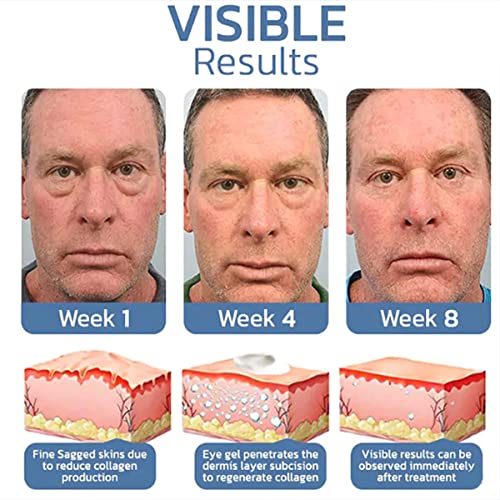 Derma+ Firm Peptide Firming Eye Gel,Openeyes Awaken Peptide Lifting Eye Gel,2023 New Men Eye Cream Anti Aging,Himse Awaken Peptide Depuffing Eye Gel,Men's Moisturizing Eye Cream (3Pcs) #TOP6