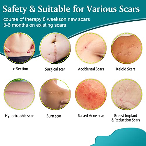 Silicone Scar Sheets,Professional Silicone Tape for Scars(16 pads-5.9”x 1.6”),Silicone Scar Tape,Scar Removal Sheets,Silicone Scar Strips for Surgical Scars, C-Section, Surgery, Burn, Keloid, Acne - Thumbnail 4